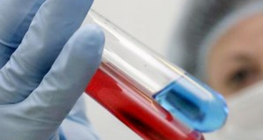 В Волгограде более 10 000  больных ВИЧ