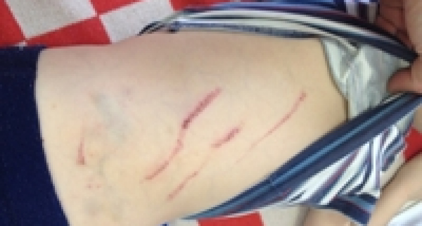 Волгоградку подозревают в избиении 5-летнего сына бывшего мужа