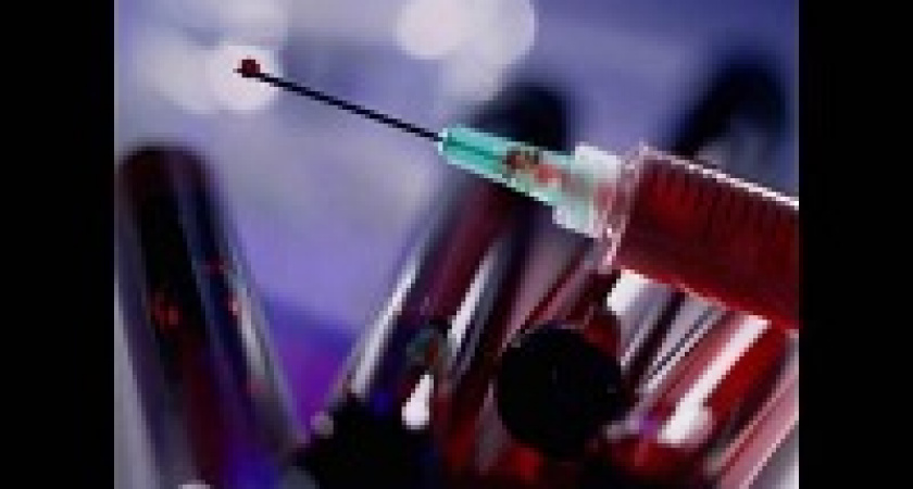 В Роспотребнадзоре назвали города-лидеры по распространению ВИЧ-инфекции