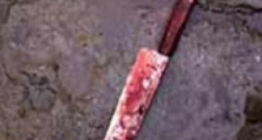 В Волжском женщина порезала ножом соседку из-за ревности