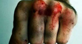 Под Волгоградом пьянка закончилась жестокими побоями  